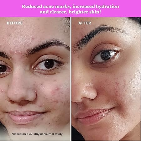 FOXTALE DELETED ITEMS NIACINAMIDE CLARIFYING SERUM 30ML