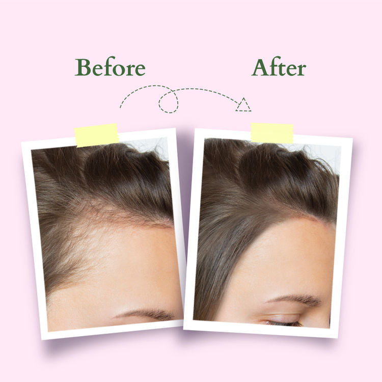 LOTUS ORGANICS HAIR GROWTH ACTIVE-CONCENTRATE SERUM 28ML
