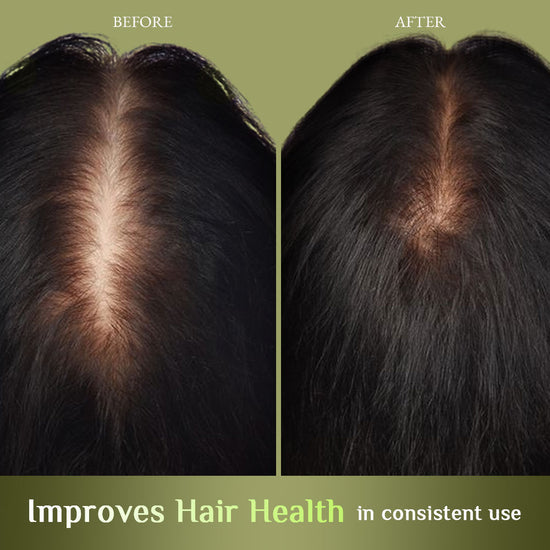 RICHFEEL BRAHMI JABORANDI NOURISHING HAIR OIL 80ML