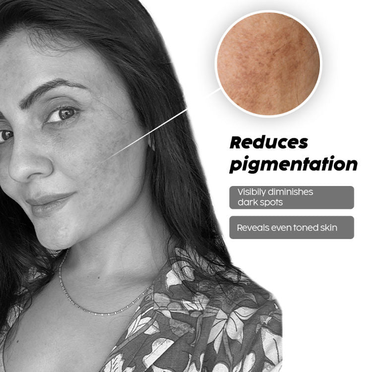 PLIX PINEAPPLE DE-PIGMENTATION DEWY SERUM 2% 30ML