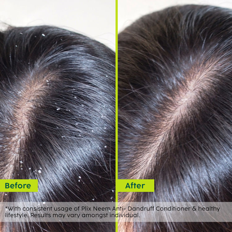PLIX NEEM ANTI-DANDRUFF ADVANCED CONDITIONER 175G