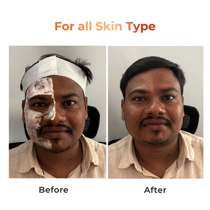 स्प्रे बोतल कैप्सूल 50ML