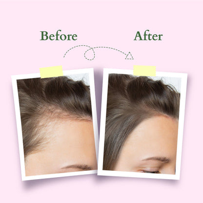 LOTUS ORGANICS HAIR GROWTH ACTIVE-CONCENTRATE SERUM 28ML