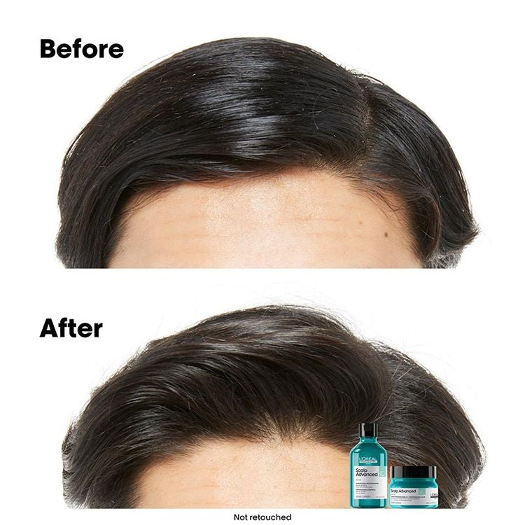 LOREAL PROFESSIONAL SCALP ADVANCED MASQUE 250 ML (R)