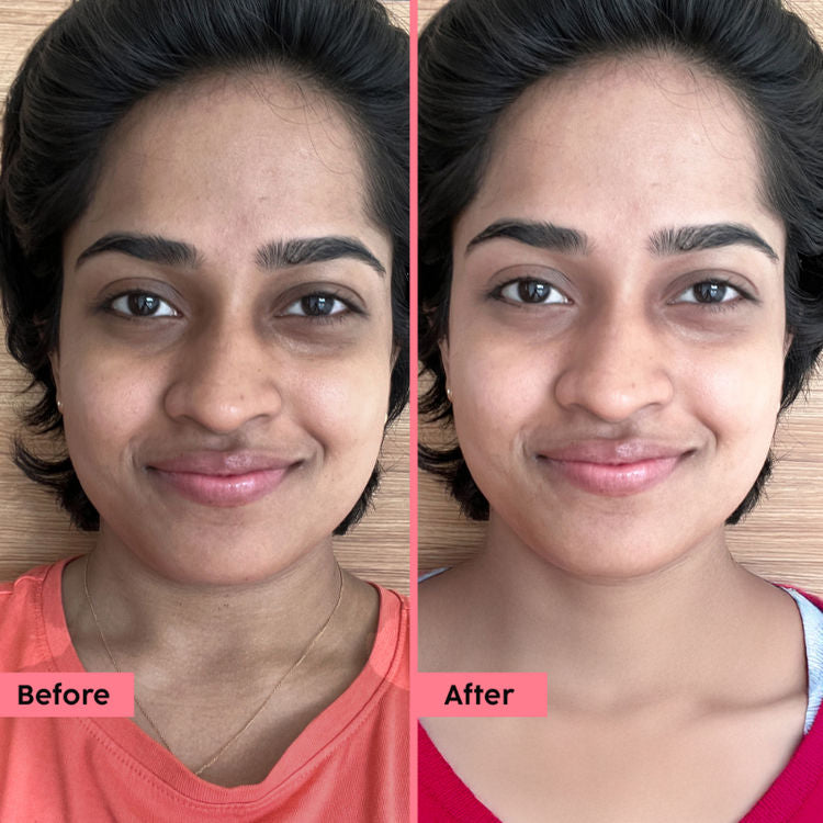 पोलर फ़ुट स्क्रेपर नैन्सी