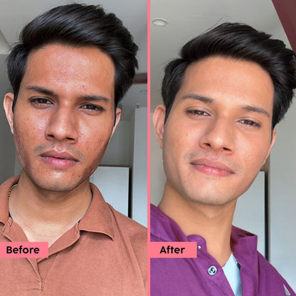 पोलर फ़ुट स्क्रेपर नैन्सी