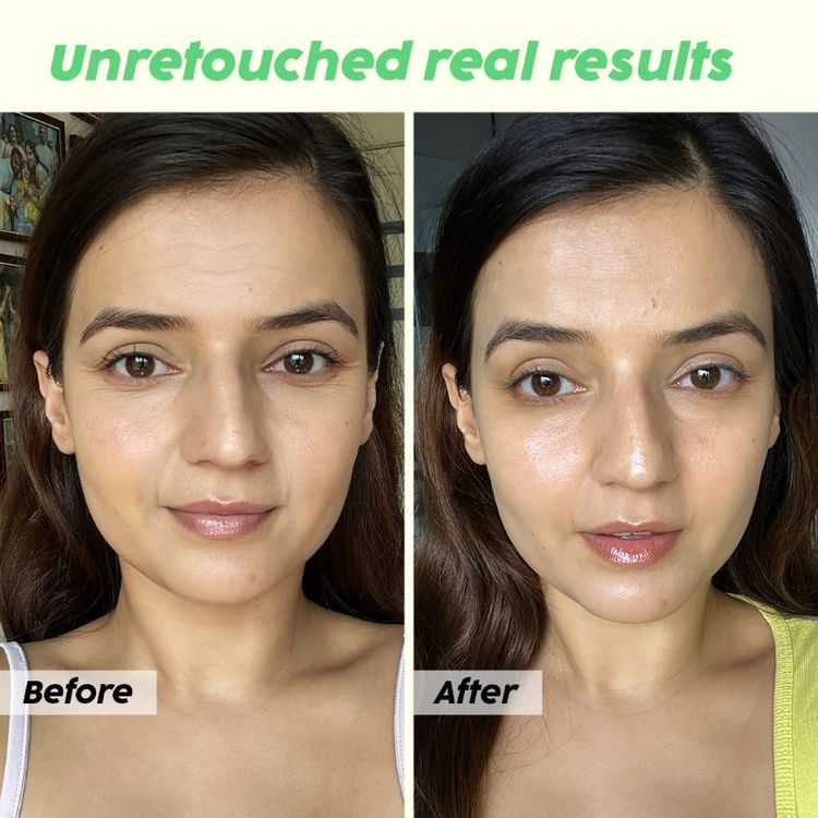 पोलर फुट स्क्रेपर फांसिया