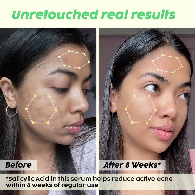 पोलर फुट स्क्रेपर देखभाल