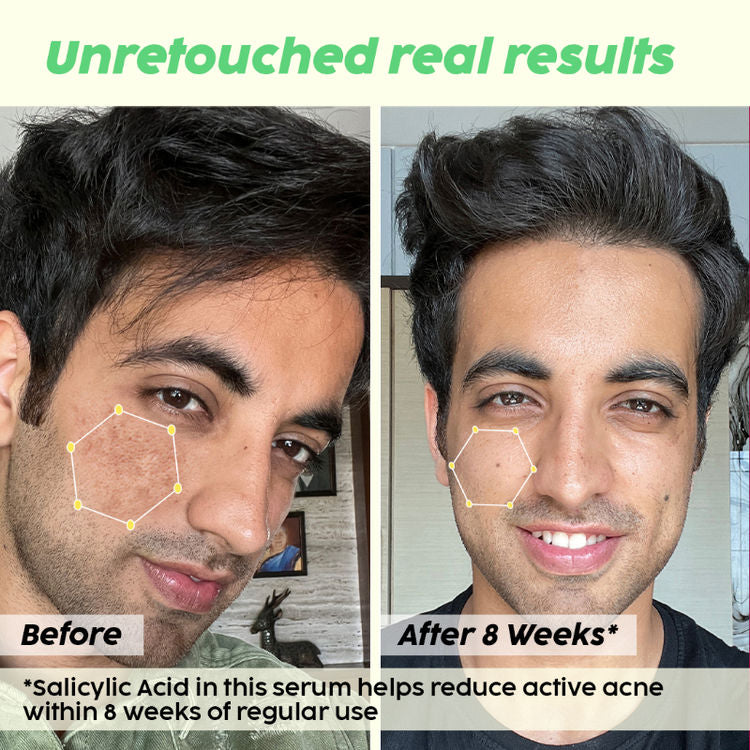 पोलर फुट स्क्रेपर देखभाल