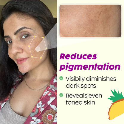PLIX PINEAPPLE DE-PIGMENTATION DEWY SERUM 2% 30ML