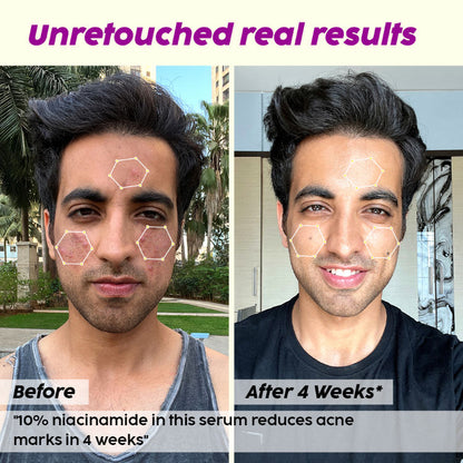 PLIX JAMUN ACNE MARKS REGIME COMBO